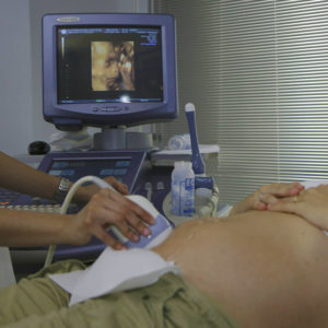 sneak-a-peek-ultrasound